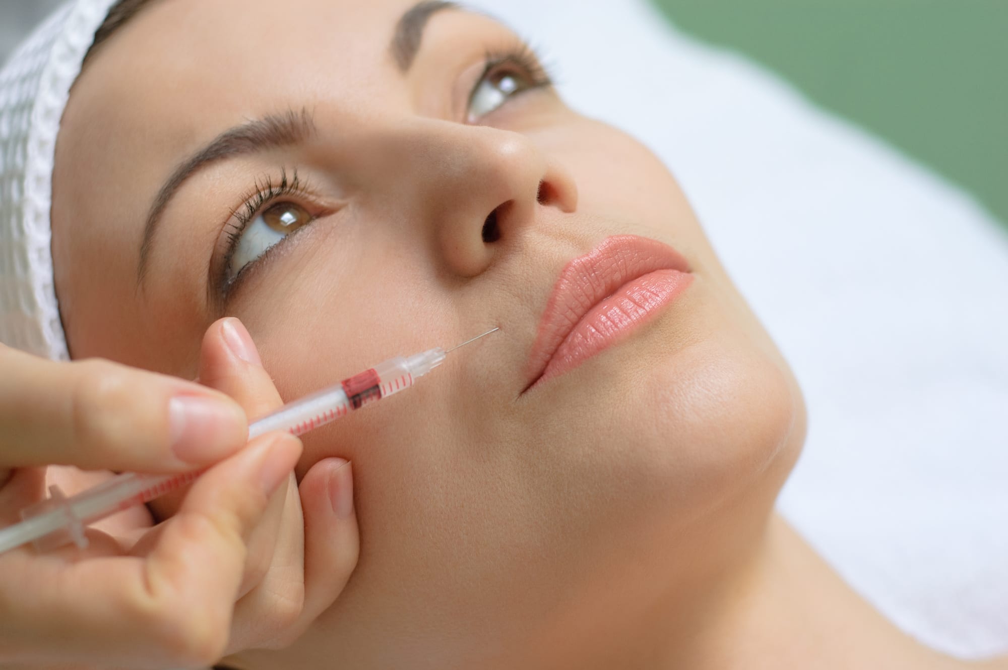 botox injection into upper lip using small syringe with thin needle