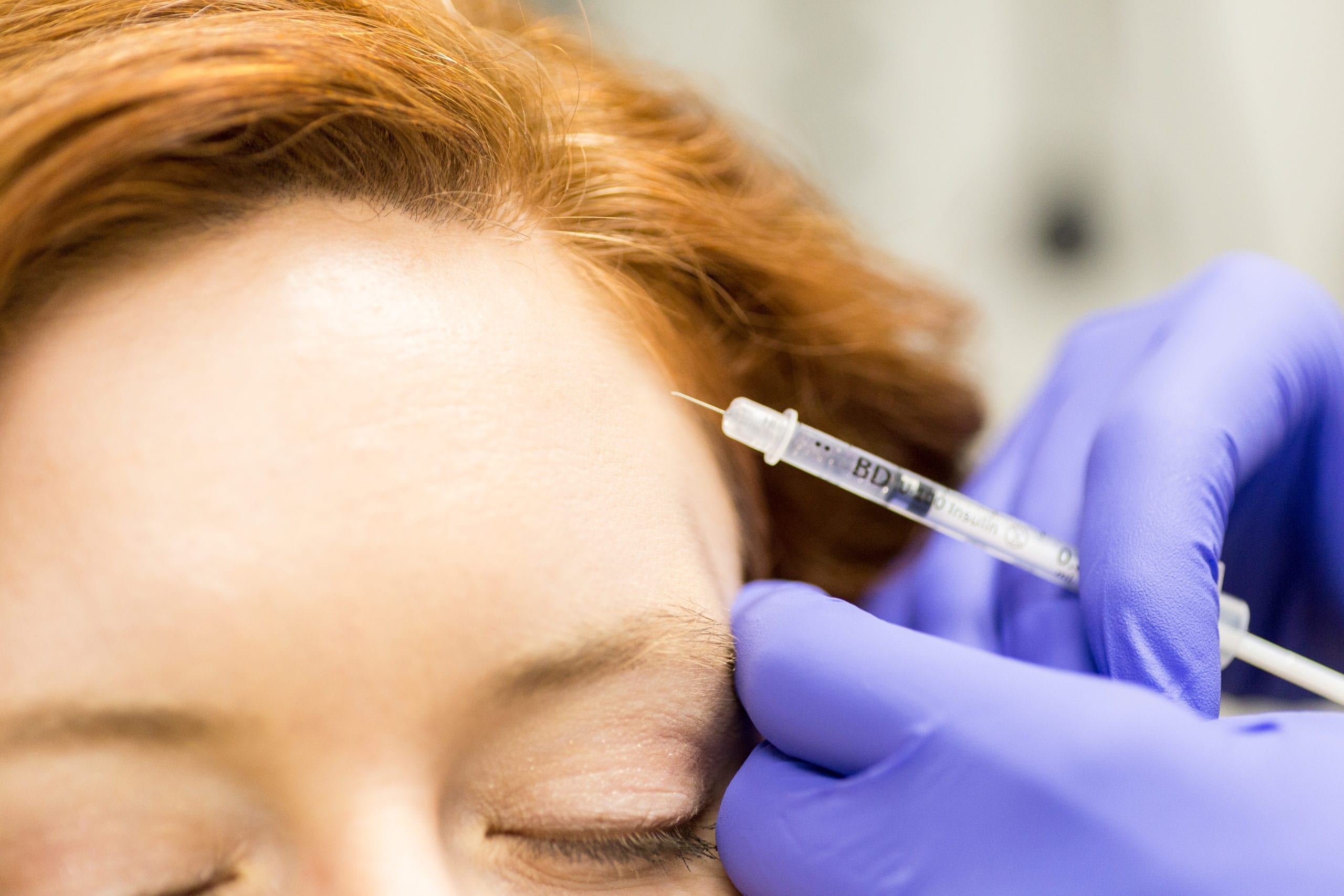 How Botox Works And Why You Need It
