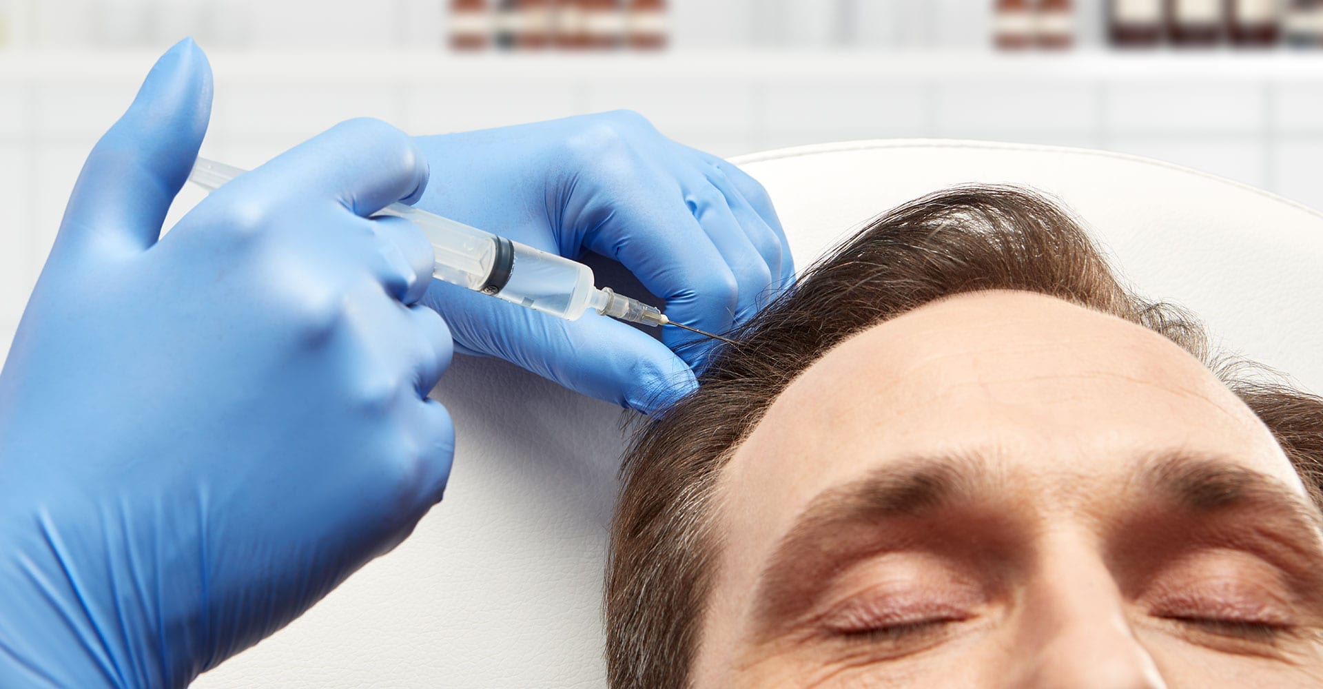 Non-Surgical Hair Restoration: Understanding the Basics of PRP Therapy -  Ageless Living Cold Lake