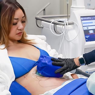 coolsculpting coolsculpting