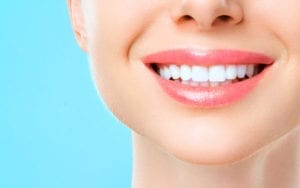 Everything you need to know about professional teeth whitening